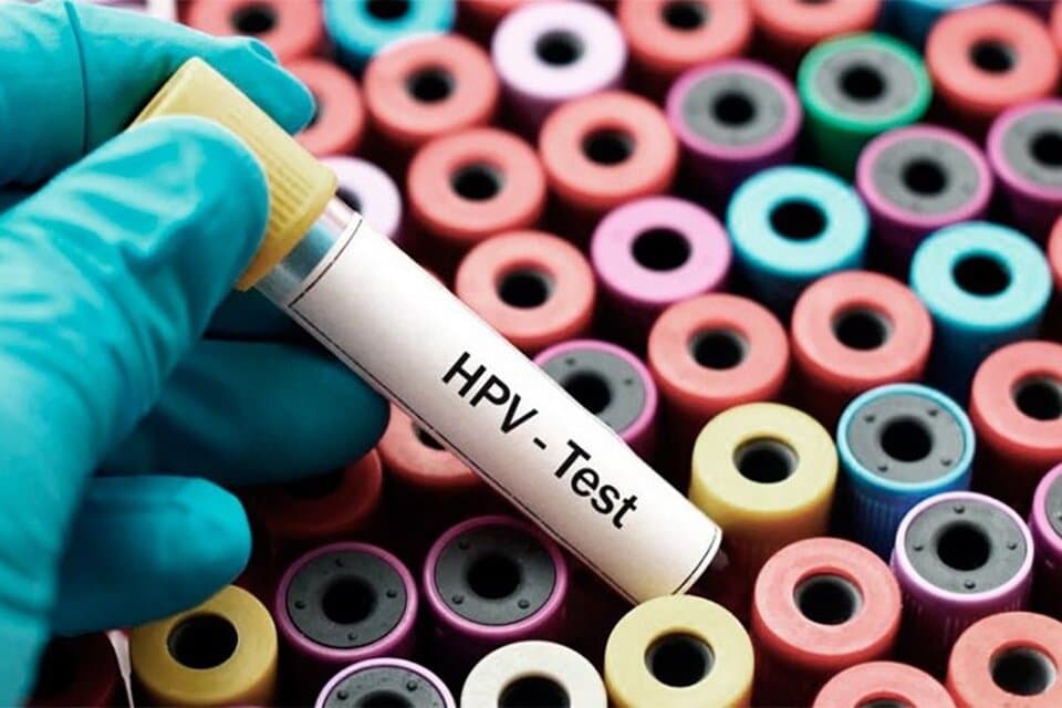 HPV: El cáncer de cuello uterino afecta a 4500 mujeres cada año