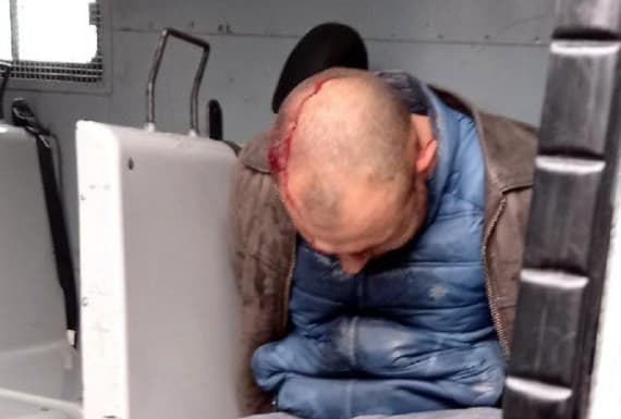 Le fracturaron el cráneo al ladrón de Vistalba